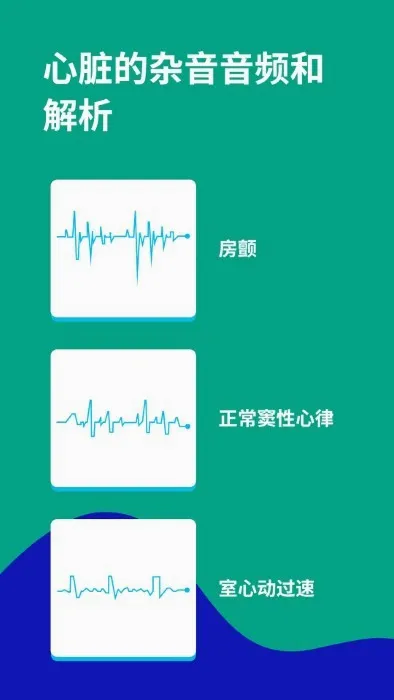 �ĵ�ͼECG(�ĵ�ͼѧϰ����)